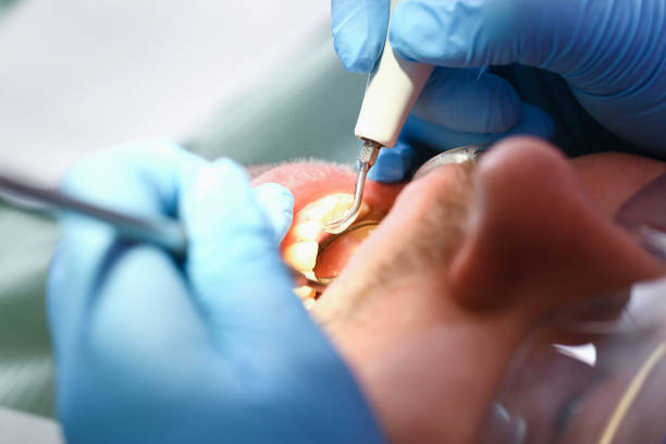 Best Same-Day Emergency Dentist in Morgandale, OH